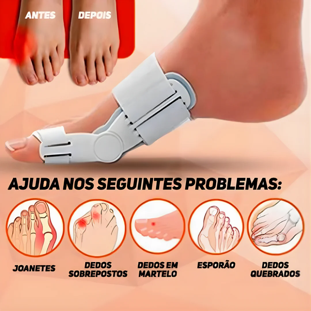 1 Par Corretor Protetor Ortopédico Articulado Para Joanete - Solução que seus pés precisam - Image 2