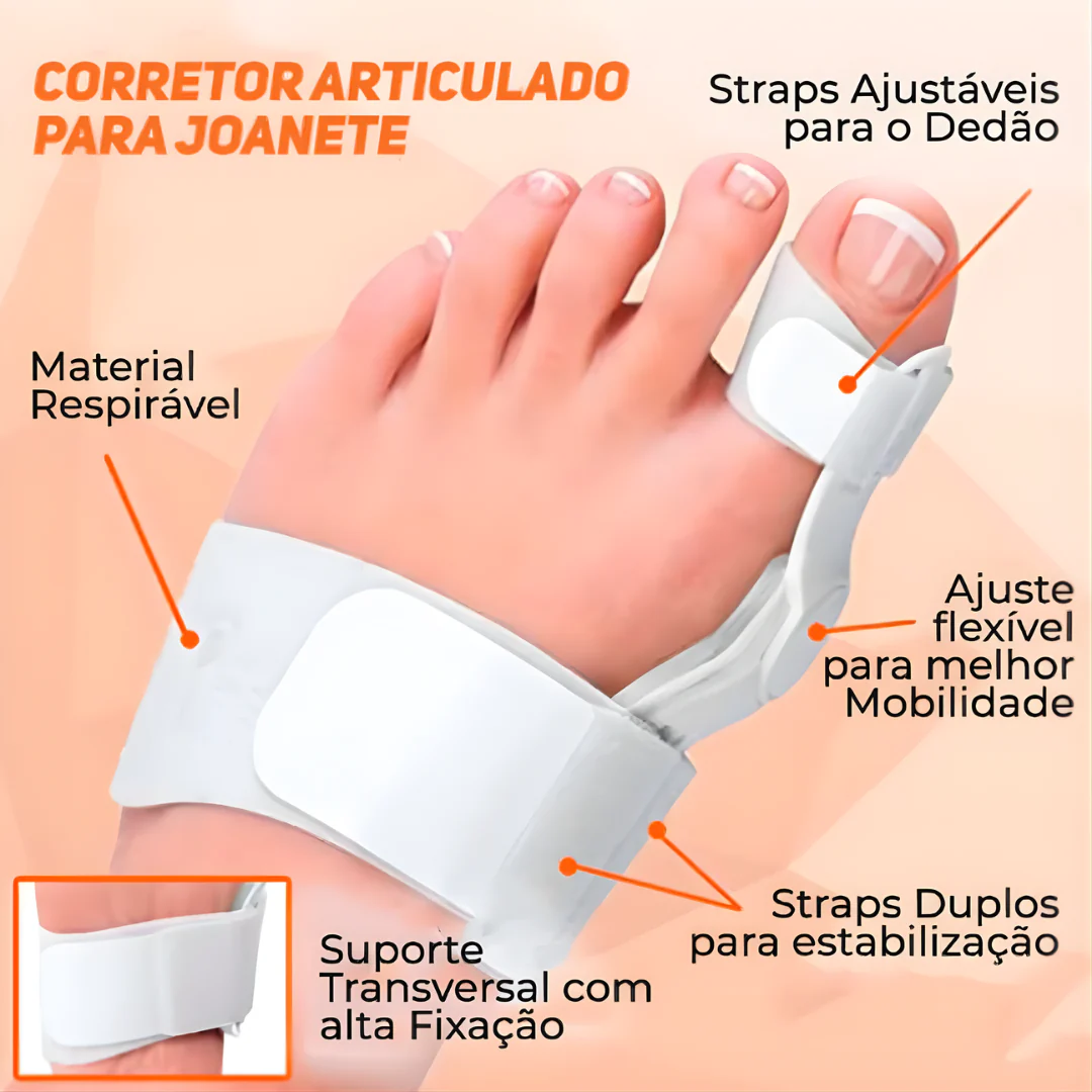 1 Par Corretor Protetor Ortopédico Articulado Para Joanete - Solução que seus pés precisam - Image 3