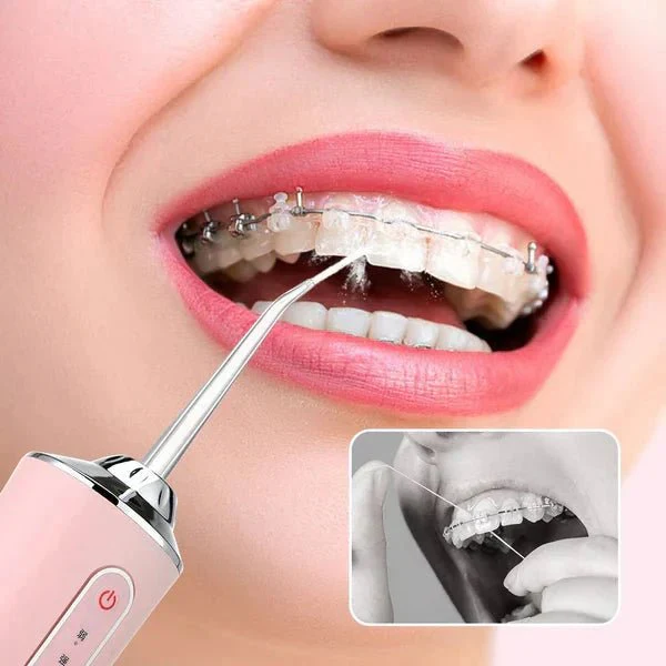 OralFlow + Kit de Acessórios Grátis! Revitalize seu sorriso com o poder da limpeza completa e eficaz! - Image 3