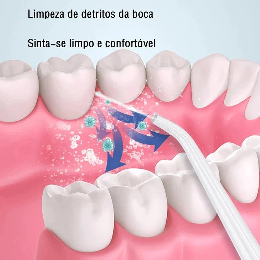 OralFlow + Kit de Acessórios Grátis! Revitalize seu sorriso com o poder da limpeza completa e eficaz! - Image 6